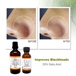 BHA Peeling Serum Manufacturer - 30% Salix Acid Anti-Acne Blackhead Dark Spot Exfoliating