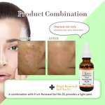 Salix Acid Peeling Serum Manufacturer - 15% Gel Anti-Acne Whitening Pore Shrinking OEM