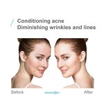 Vitamin A Peeling Serum Manufacturer - Skin White Peel Pigmentation Milk Acid Aloe Vera