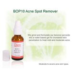 Benzoyl Peroxide Gel Manufacturer - 10% Sulfur Ultimate Pimples Blackheads Anti Acne