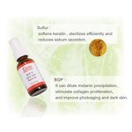 Benzoyl Peroxide Gel Manufacturer - 10% Sulfur Ultimate Pimples Blackheads Anti Acne