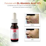 Whitening Set Manufacturer - Mandelic Acid Pore Minimizer Serum Facial Skin Care