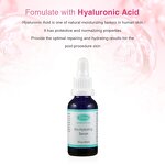 Whitening Set Manufacturer - Mandelic Acid Pore Minimizer Serum Facial Skin Care