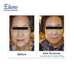 V-Line Microcurrent Machine Manufacturer - Bio Desktop Salon Face Slimming Wrinkle Removal