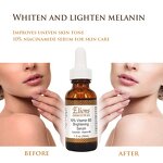 Niacinamide Vitamin B5 Serum Manufacturer - 10% Oil-Free Skin Blemishes Brightening Anti-Aging