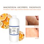 Professional Foot Care Set Manufacturer - Cream Gel Mask Dead Skin Callus Remover Liquid