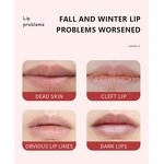 Lip Scrub Wholesale Supplier - Hot Selling Gently Exfoliate Coconut Peach Strawberry Watermelon Sugar