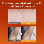 Body Brightening Spray Manufacturer - with Kojic Acid Turmeric Peeling Solution Gently Exfoliates Dead Skin