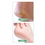 Foot Cream Manufacturer - Urea Moisturizing Repair for Cracked Heels Dry Feet Paraben-Free 100ml & Custom Private Label