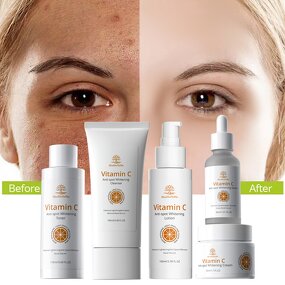 Skin Care Set Manufacturer - Vitamin Lightening VC Whitening Organic Korean Vitamin C & Private Label