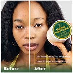 Whitening Cream Manufacturer - Strong Removal for Freckles Fade Dark Spot Black Skin Bleaching