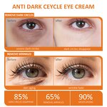 Eye Cream Manufacturer - OEM Vitamin C Hyaluronic Acid Organic Vegan Dark Circle Remove