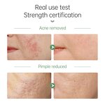 Tea Tree Face Wash - JoyPretty Private Label Deep Cleansning Pore Moisturizing Oil Control