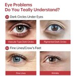 Rapid Rejuvenatist Eye Cream - JoyPretty Organic Smoothing Instant Eyebags Dark Circles Remove