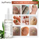 Toe Nail Gel - Wholesale Anti Fungal Nail Repair Solution Onychomycosis Removal Serum