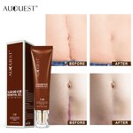 TCM Scar Repair Gel - Wholesale Acne Mark Removal Stretch Mark Skin Treatment