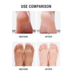Urea Foot Cream - Private Label 40% Whitening Repair Moisturizing Peel Crack Heel Care