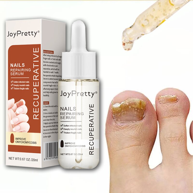 Toe Nail Fungus Gel - Fungal Treatment Whitening Anti Infection Foot Repair Liquid