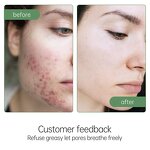 Tea Tree Face Wash - JoyPretty Private Label Deep Cleansning Pore Moisturizing Oil Control