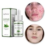 Tea Tree Acne Serum - JoyPretty Natural Organic Moisturizing Whitening Dark Spot Remover