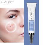 Acne Removal Cream - AuQuest Private Label Organic Dark Spot Shrinking Pore Whitening