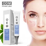 Acne Removal Cream - AuQuest Private Label Organic Dark Spot Shrinking Pore Whitening