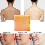 Papaya Soap - Wholesale Organic Skin Brightening Rose Oil Handmade Soap Private Label