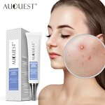 Acne Removal Cream Gel - Stretch Marks Desalt Quick Effective No Side Effects