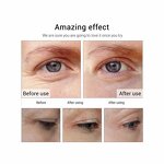 Hyaluronic Acid Serum - Private Label Anti Aging Moisturizing Nourishing Anti Wrinkle