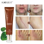 TCM Scar Repair Gel - Wholesale Acne Mark Removal Stretch Mark Skin Treatment