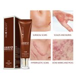 Scar Removal Cream Gel - Private Label Organic TCM Acne Scar Stretch Mark Repair Ointment