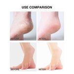 Urea Foot Cream - Private Label 40% Whitening Repair Moisturizing Peel Crack Heel Care
