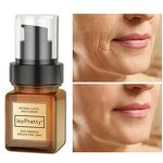 Retinol Serum - JoyPretty Organic Skin Firming Whitening Anti Aging Fade Fine Lines Facial