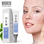 Acne Removal Cream - AuQuest Private Label Organic Dark Spot Shrinking Pore Whitening