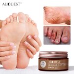 Foot Care Cream - Herbal SPA Pedicure Detox Anti Fungal Onychomycosis Fungus Treatment