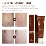 Scar Removal Cream Gel - Private Label Organic TCM Acne Scar Stretch Mark Repair Ointment