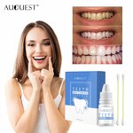 Teeth Whitening Liquid - Professional Dental Fluid Cleaning Oral Stains Removal Treatment