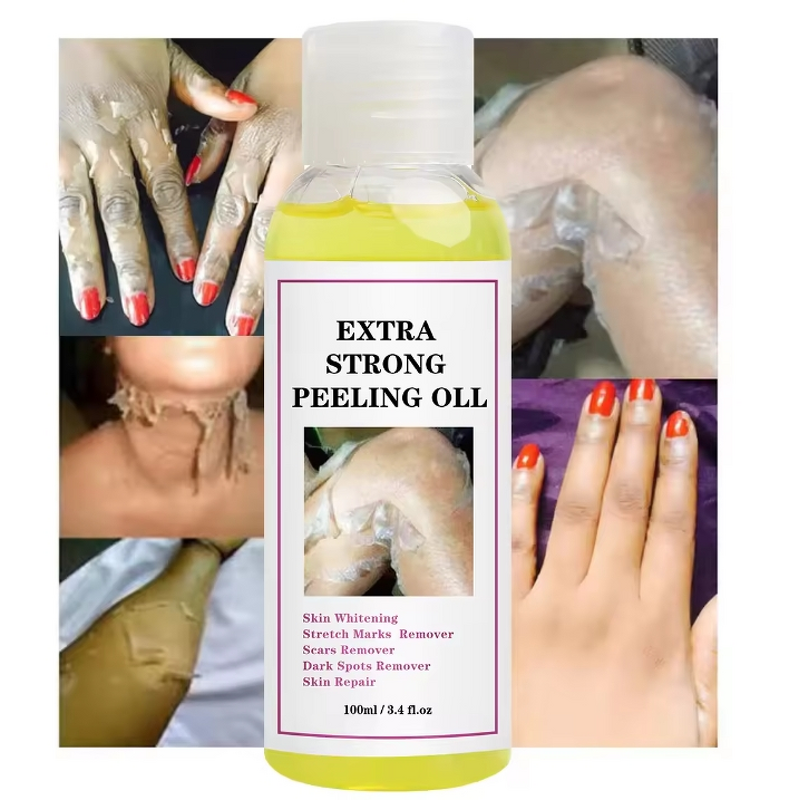Peeling Oil Manufacturer - Yellow and Green Knuckle Whitening Moisturizing Dark Spot Removal Extra Strength & SKIH OEM