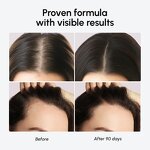 Rosemary Hair Serum - Private Label 7% Biotin Caffeine 100 Peptides Anti Hair Loss Growth