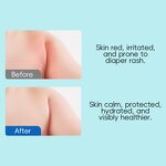 Diaper Cream - Private Label Centella Asiatica Cocoa Seed Butter Smooth Hydrated Baby Skin