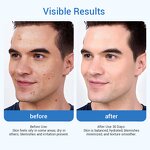 Herbal Repair Cream - Private Label Niacinamide Panthenol Tea Tree 50ml Blemishes Minimized