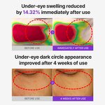 PDRN Retinol Eye Patch - Private Label Glutathione Niacinamide Anti Aging Dark Circle Puffiness