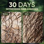 Batana Oil Shampoo - Private Label Rosemary Ginger Castor Anti Hair Loss Scalp Treatment