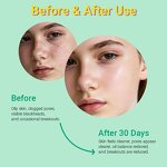 Salicylic Acid Clarifying Gel - Private Label OEM Teens Acne-Fighting pH Balancing Sulphate-Free