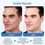 Men Face Care Set - Oil Control Moisturizing Fewer Acne Scars Dark Spots OEM ODM Accept