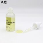 Green Tea Acne Serum - Private Label OEM Blackhead Remover Skin Care Acne Treatment