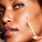 BHA Zinc Oxide Acne Serum - OEM Quickly Clear Pimples Control Oil Reduce Redness