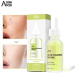 Green Tea Acne Serum - Private Label OEM Blackhead Remover Skin Care Acne Treatment