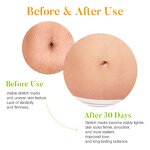 Anti Stretch Mark Set - Private Label Organic Sweet Almond Argan Pregnancy Scar Removal