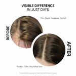 Capixyl Redensyl Serum - Private Label Hair Growth 30mL Control Fall Stimulates Growth